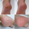 Solemate Heel Repair Balm Set Lavender
