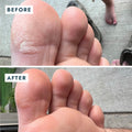 toe before and after