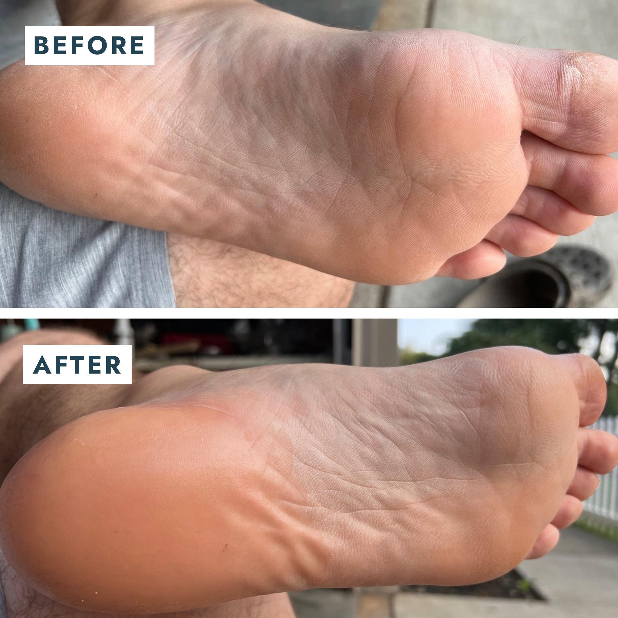 Solemate Heel Repair Balm