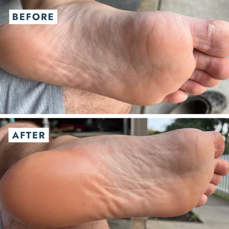 foot before and after