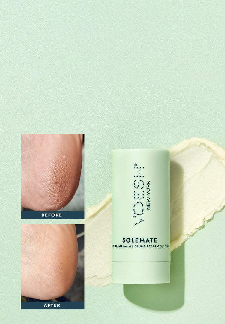 Solemate Heel Repair Balm on top of swipe of balm’s texture. Before-and-after pictures of dry heel and moisturized heel.