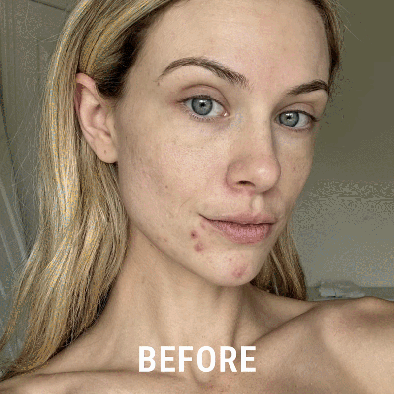 Vitamin C Shower Filter