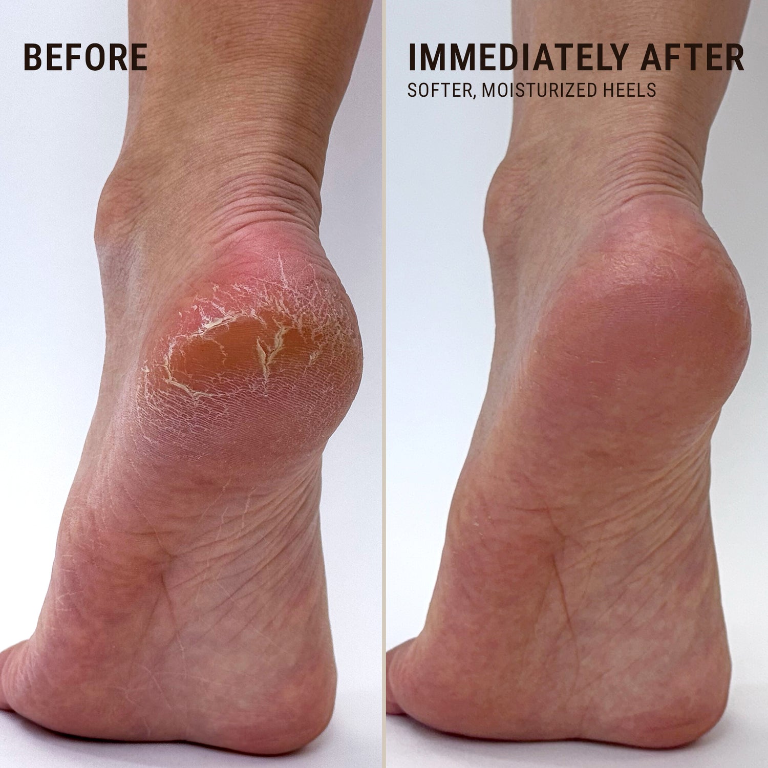 Moisturizing Heel Socks